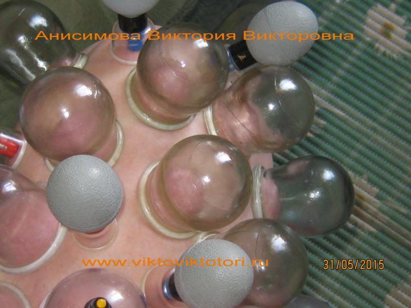 Шугаринг, депиляция удаление волос 